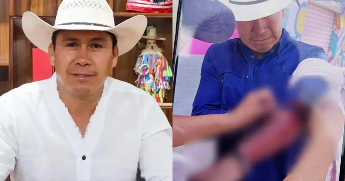 César Figueroa sufrió lesiones, pero su salud es estable tras el atentado.