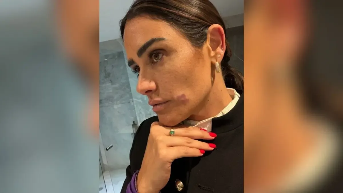 La edil y su equipo fueron atacados durante un operativo contra el comercio ambulante en la CDMX.