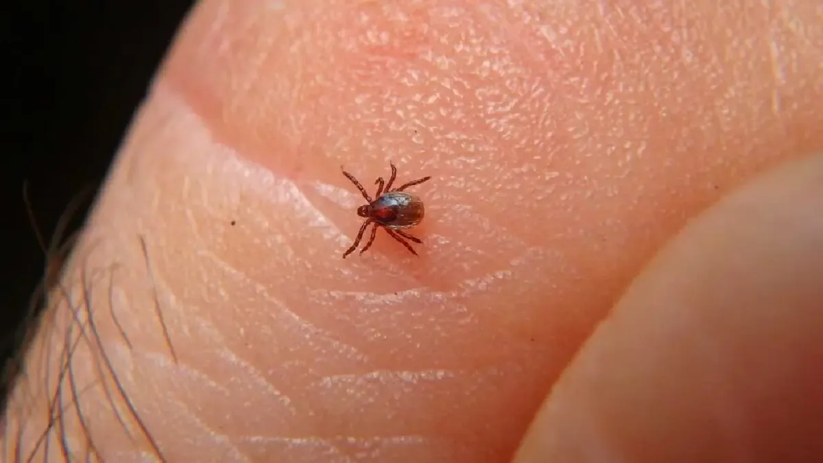 La rickettsia, enfermedad endémica en La Laguna, muestra un incremento alarmante en su incidencia.