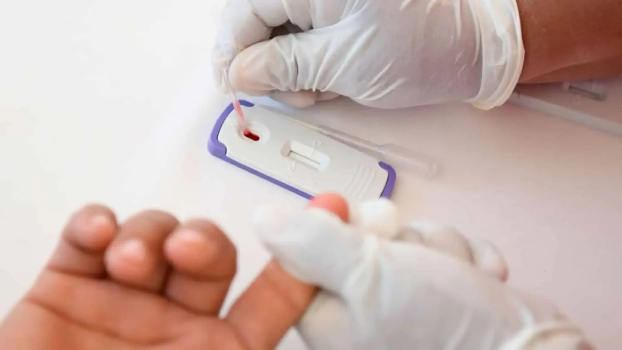 Aumento del VIH en la península de Yucatán genera alarma en autoridades sanitarias.