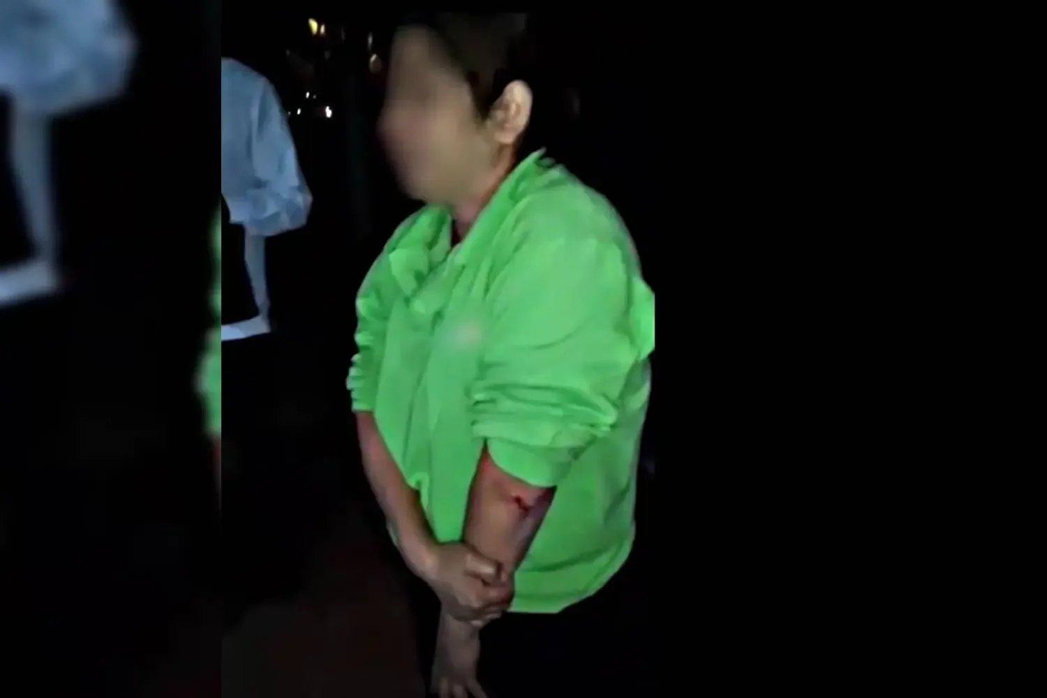 Ciudadana lesionada al descender de un camión en Los Cabos.