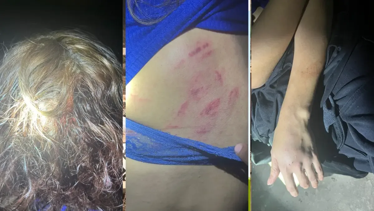 Un joven agredió a su pareja en un ataque de violencia familiar durante la madrugada del 28 de octubre.