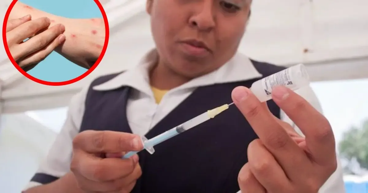 La CDMX implementa módulos de vacunación nocturna para combatir el sarampión.