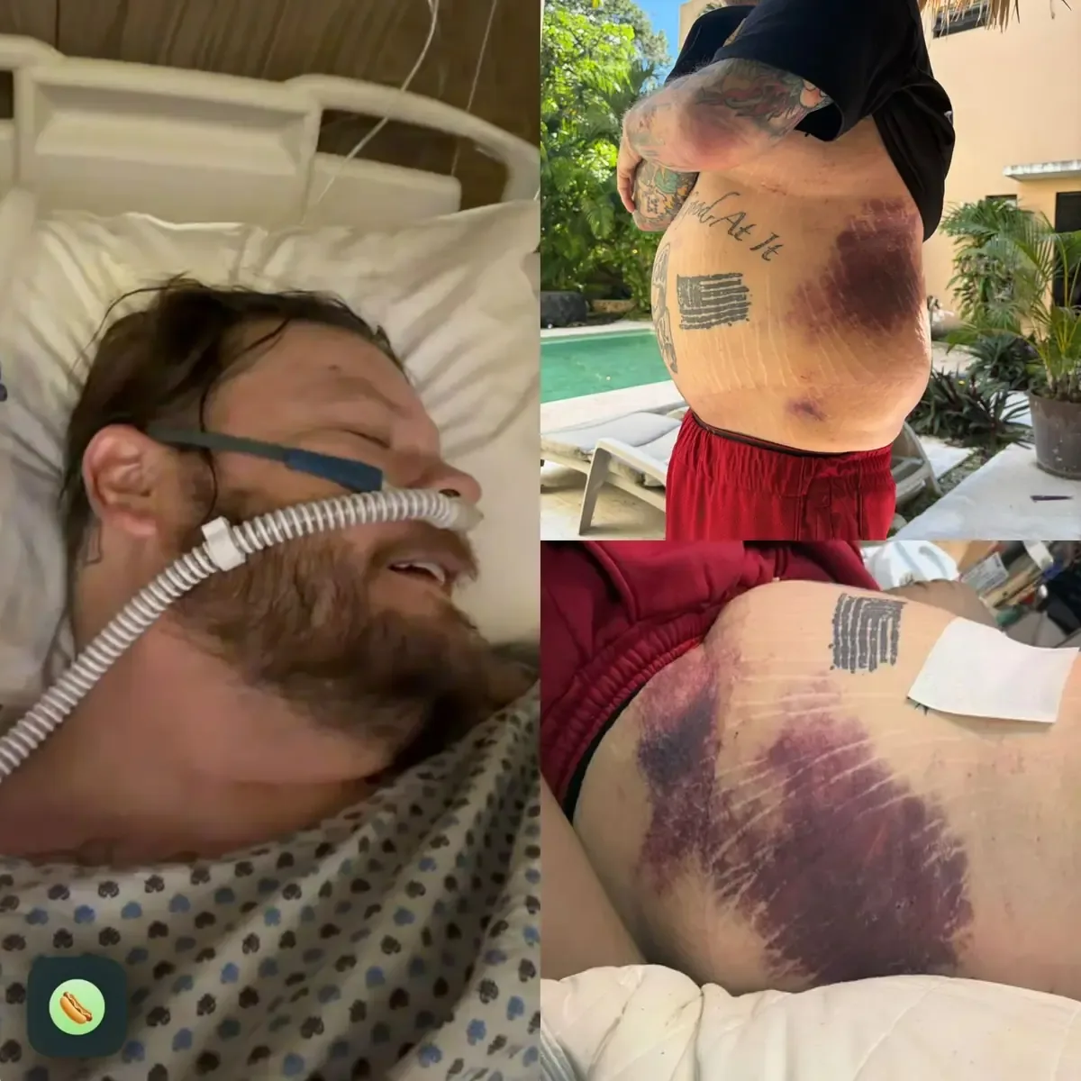La estrella de “El Precio de la Historia” enfrenta altos costos médicos tras un accidente en Tulum.