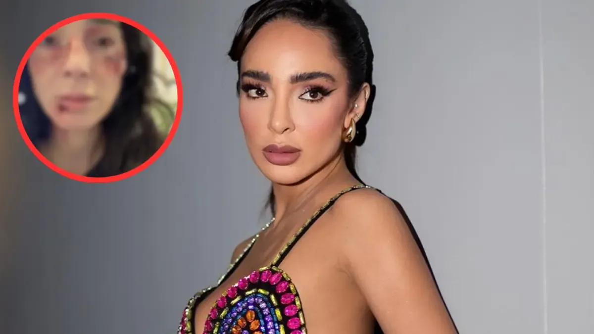 La influencer muestra un rostro desfigurado, que resulta ser parte de un proyecto actoral.
