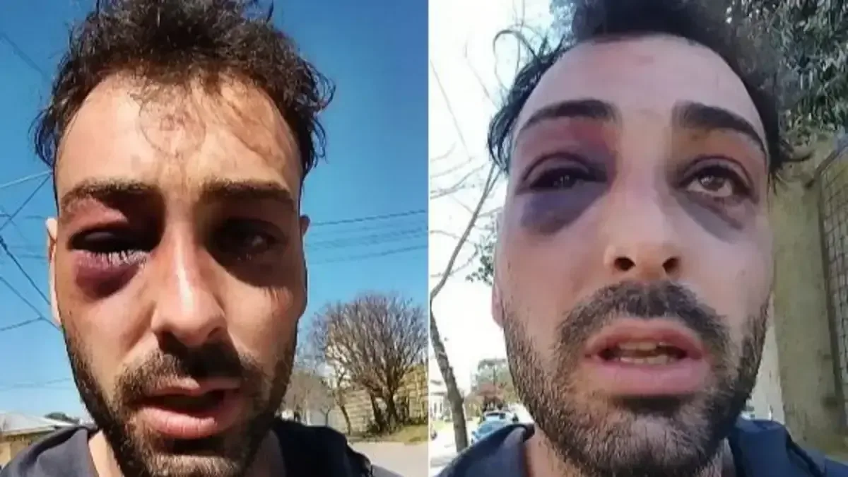 Lautaro Ruiz, luthier de La Plata, fue golpeado por policías tras un malentendido en una terminal de autobuses.