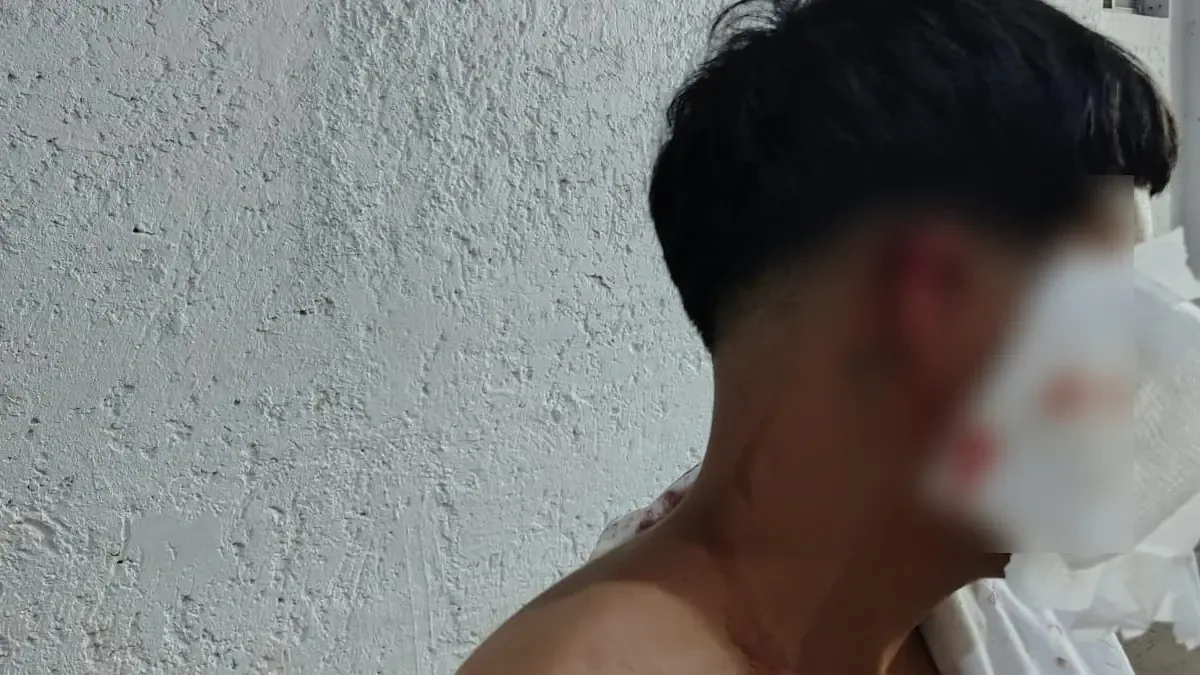 Un joven de 17 años fue agredido durante una pelea en la calzada Colón.