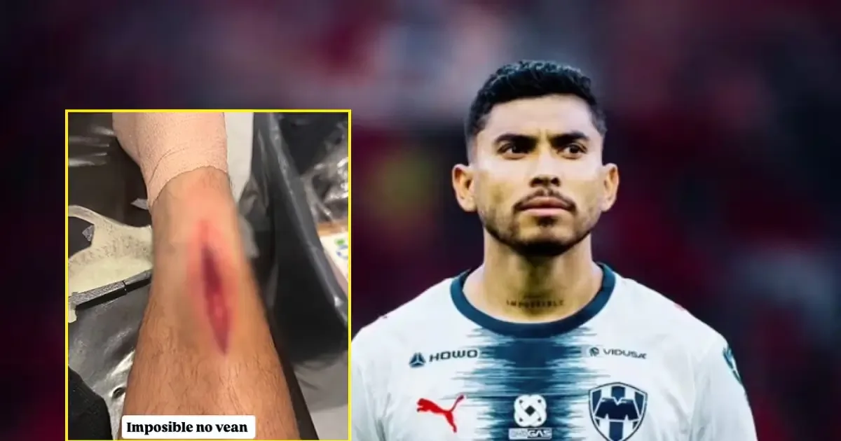 El mediocampista de Rayados sufrió un corte profundo en la pierna durante la Jornada 3 del Apertura 2026.