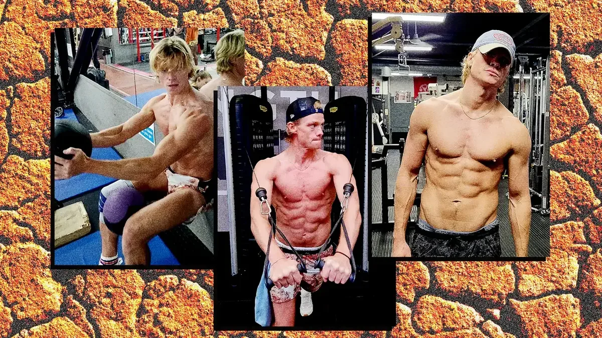 El actor Tom Rhys Harries se preparó para el papel de Clayface con una grave lesión en la rodilla.