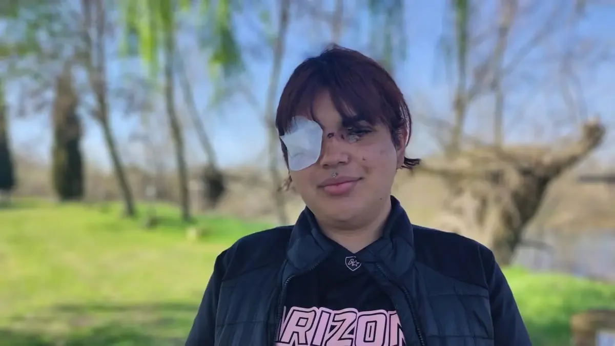Una joven trans sufrió una brutal paliza y denuncia el odio hacia su comunidad.